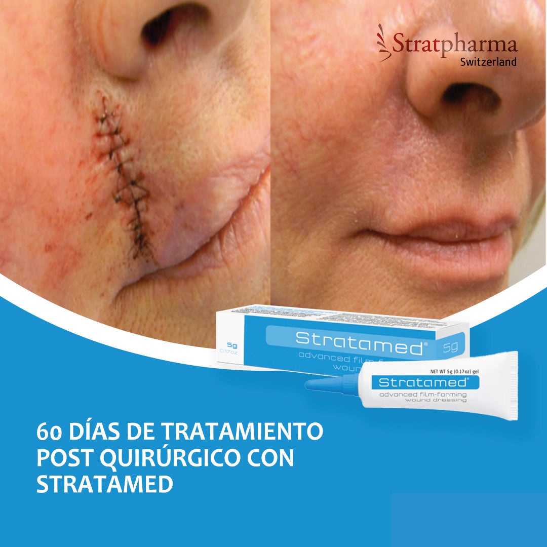 Stratamed 10g